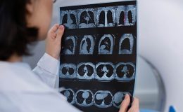 Uzmanından uyarı: ‘Kan sulandırıcı kullanımı beyin kanaması riskini artırabilir’