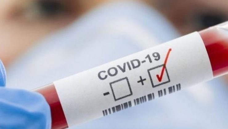 Uzmanlar kanıtladı, ‘oyun bitti’: Kalp krizi ve pıhtının sebebi Covid aşıları mı?