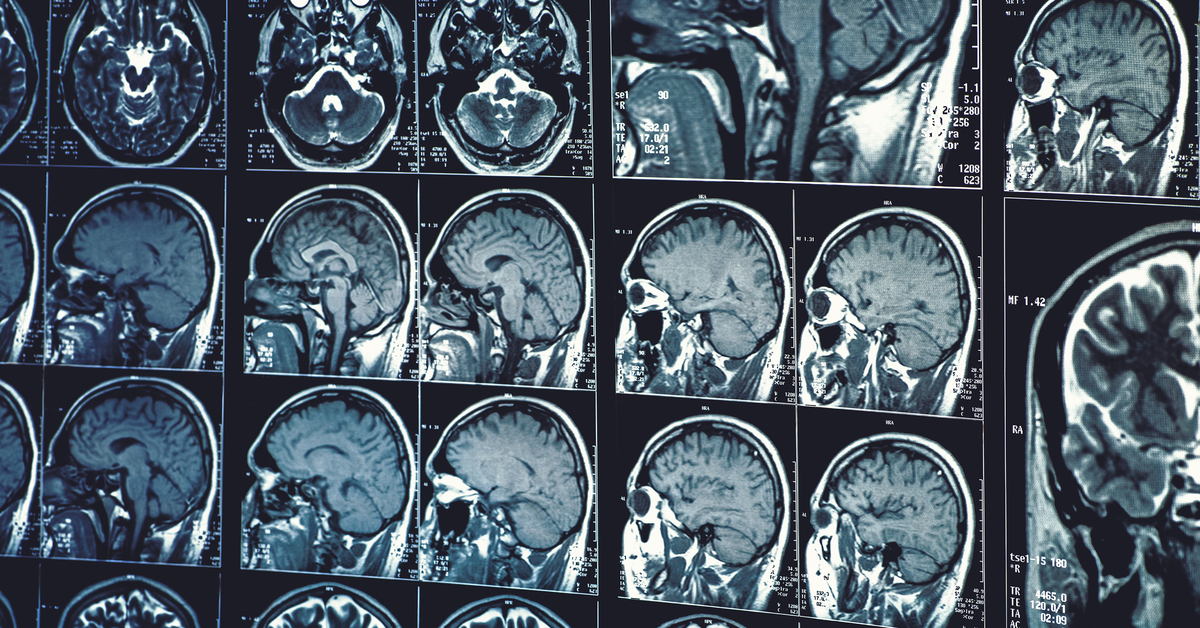 İnme ve beyin hasarı sonrası yeni bir yaşama adım attılar