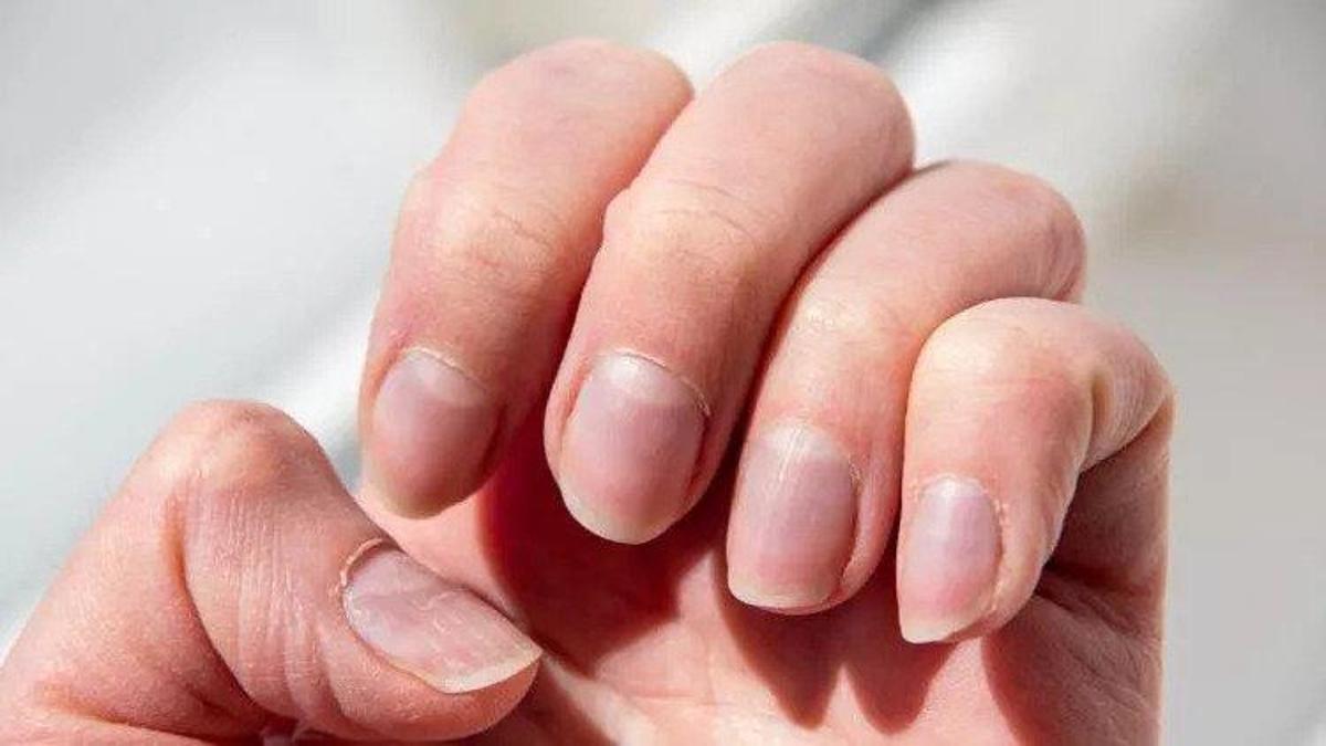 Tırnak sağlığı haberleri… Tırnak İçin Hangi Doktora Gidilir? Tırnak Hastalıklarına Hangi Bölüm Bakar?